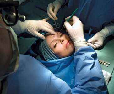 Eye Surgeon